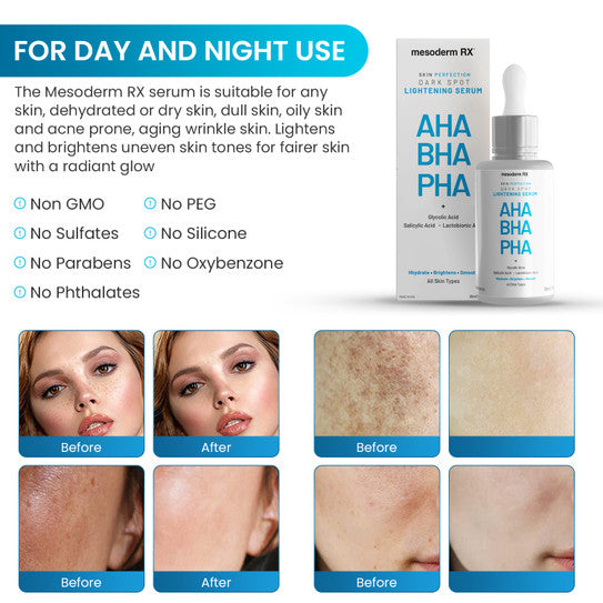 Mesoderm RX AHA BHA PHA Dark Spot Lightening Serum - Mesoderm | Evens Skin Tone