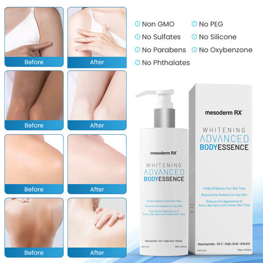 Mesoderm RX Whitening ADVANCED Body Essence Lotion