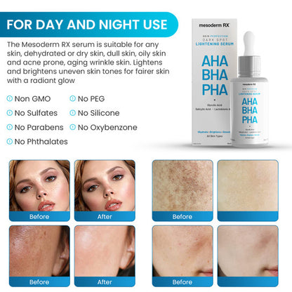 Mesoderm RX AHA BHA PHA Dark Spot Lightening Serum - Mesoderm | Evens Skin Tone