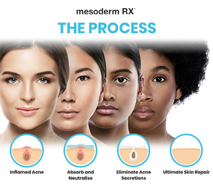 Mesoderm Intensive Acne Patch - Mesoderm | Targets Blemishes for Clearer Skin