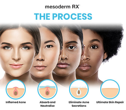 Acne Intensive Patch - Mesoderm RX | Targets Blemishes for Clear Skin