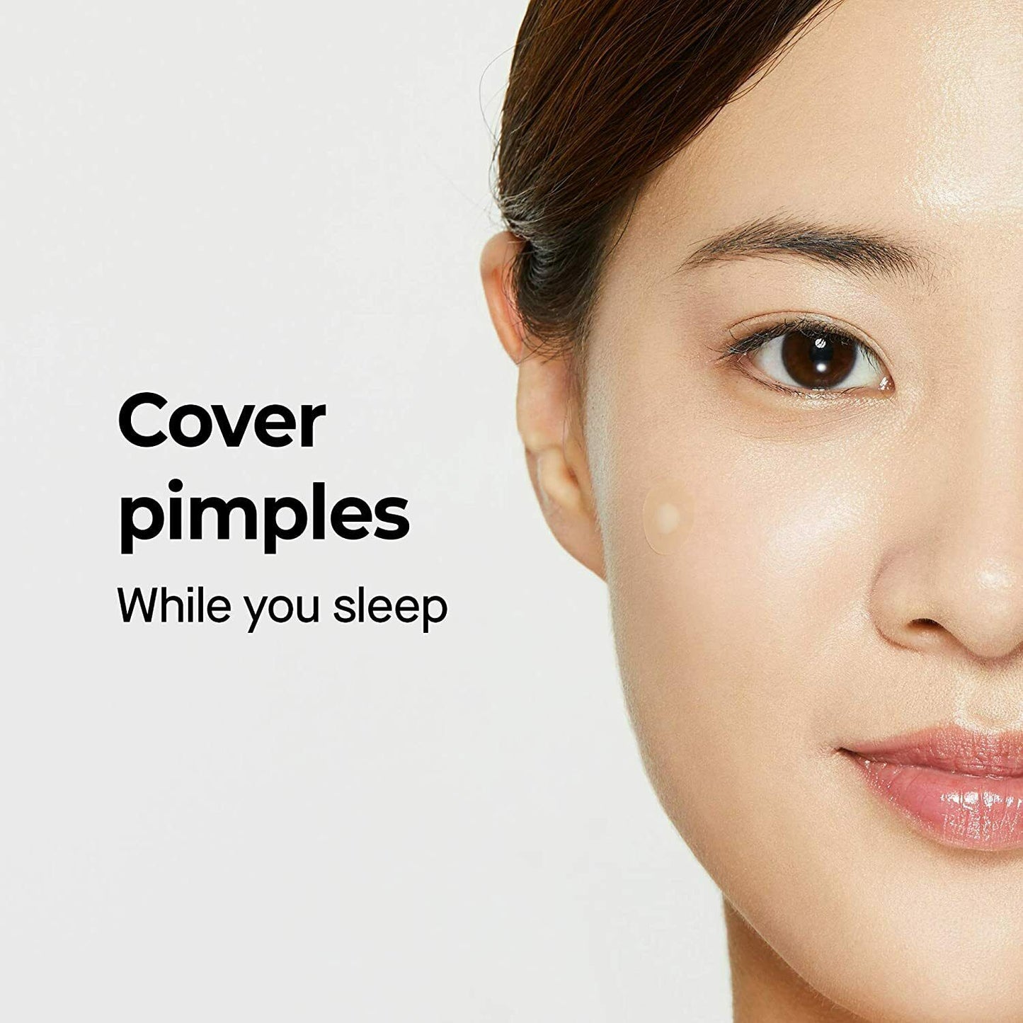 Acne Intensive Patch - Mesoderm RX | Targets Blemishes for Clear Skin