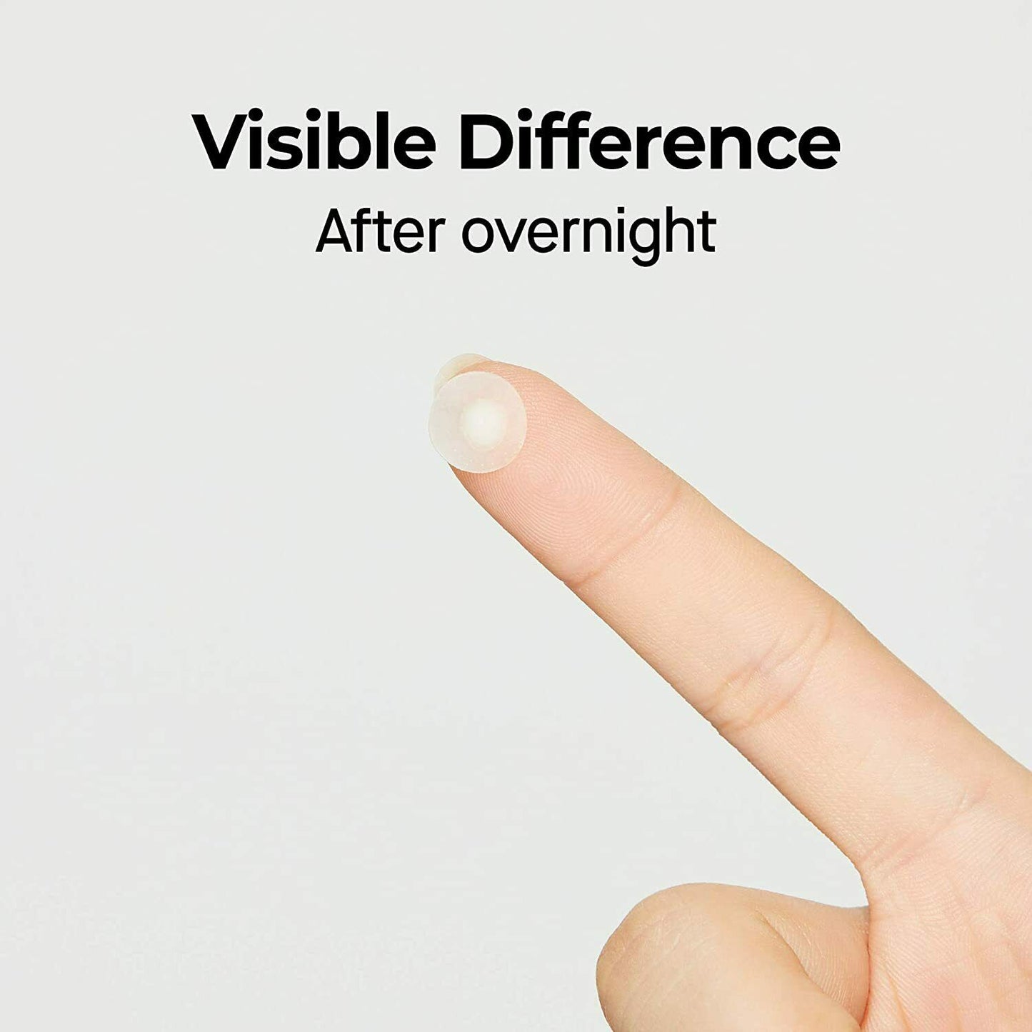 Acne Intensive Patch - Mesoderm RX | Targets Blemishes for Clear Skin